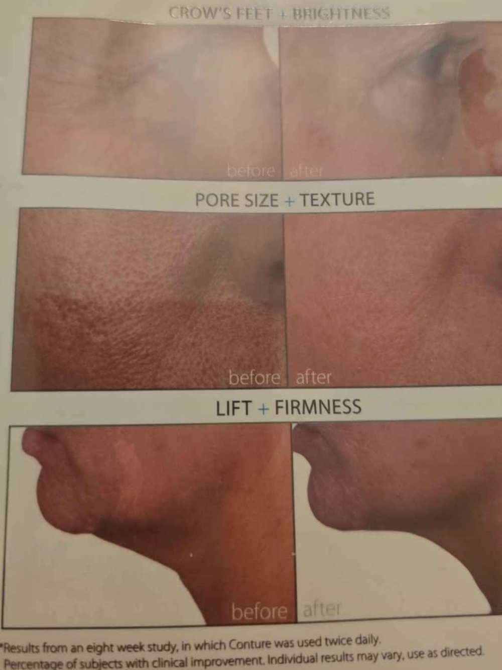 Conture face+neck skin enhancement  system Kinetic skin toning